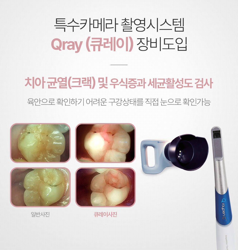 특수카메라 촬영시스템 Qray (큐레이) 장비도입